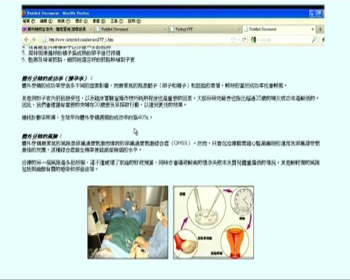 
輔助生育所錯誤移植胚胎