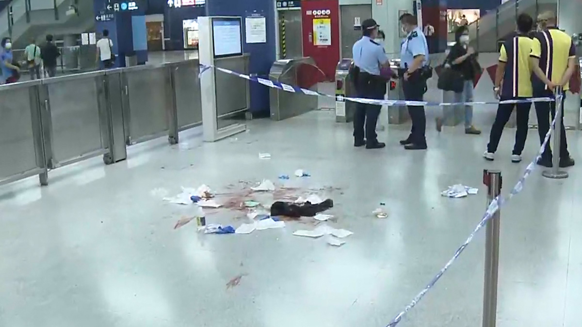 男子在港鐵大圍站遇劫受傷　損失一名表