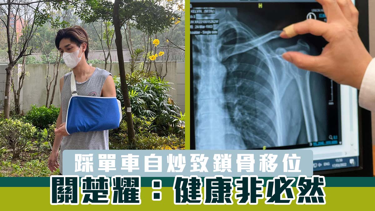 踩單車自炒致鎖骨移位　關楚耀：健康非必然