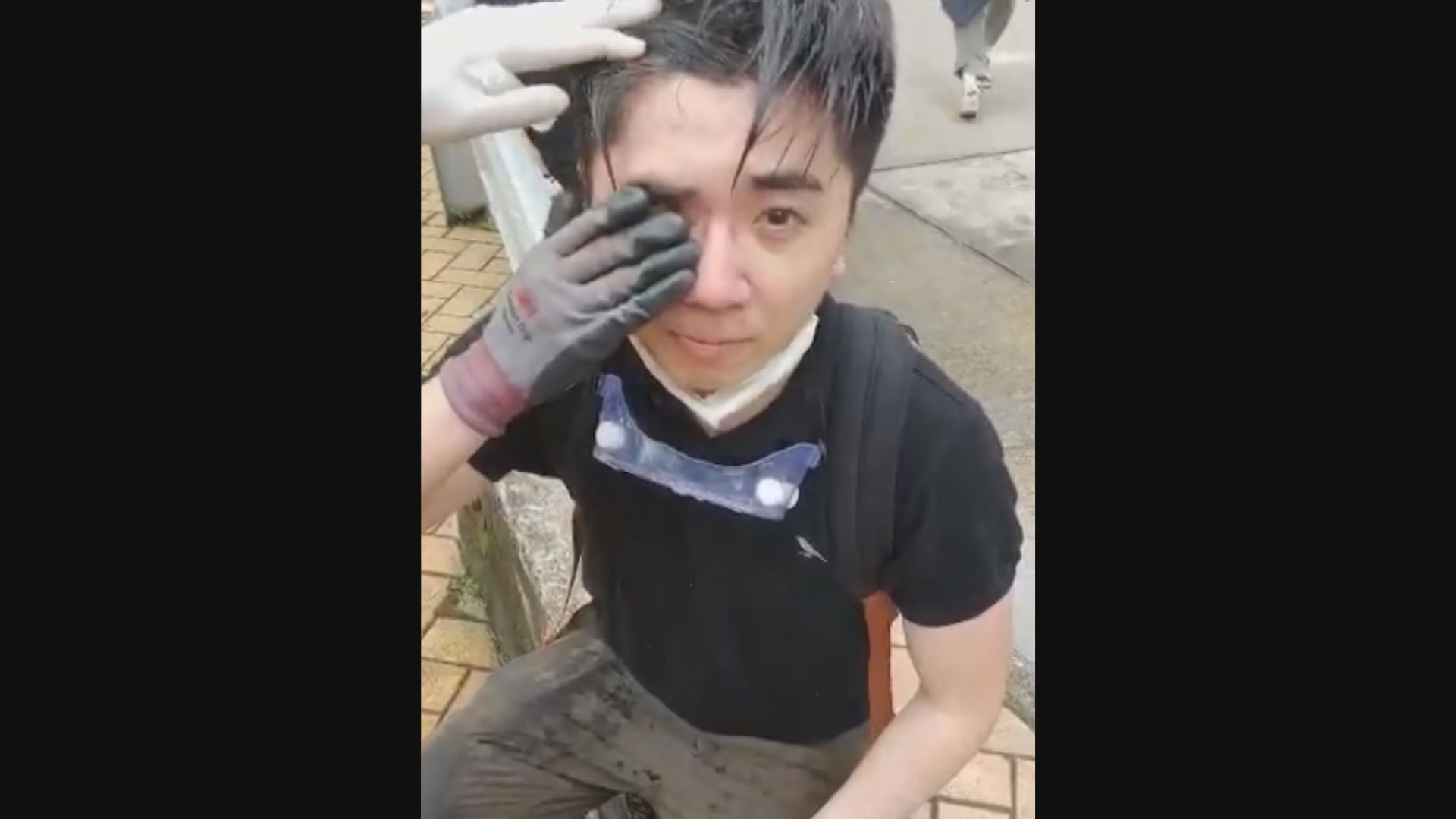 反修例示威中右眼受傷前教師楊子俊被控非法集結