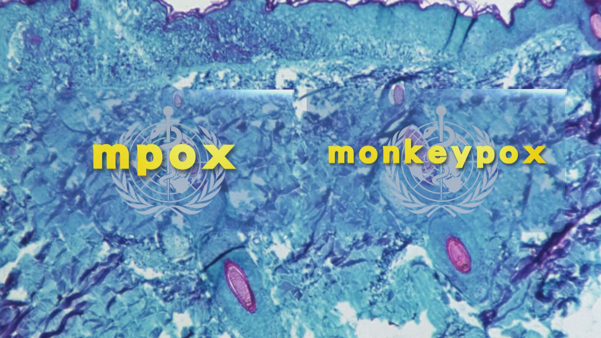 世衛：猴痘英文monkeypox易名為mpox