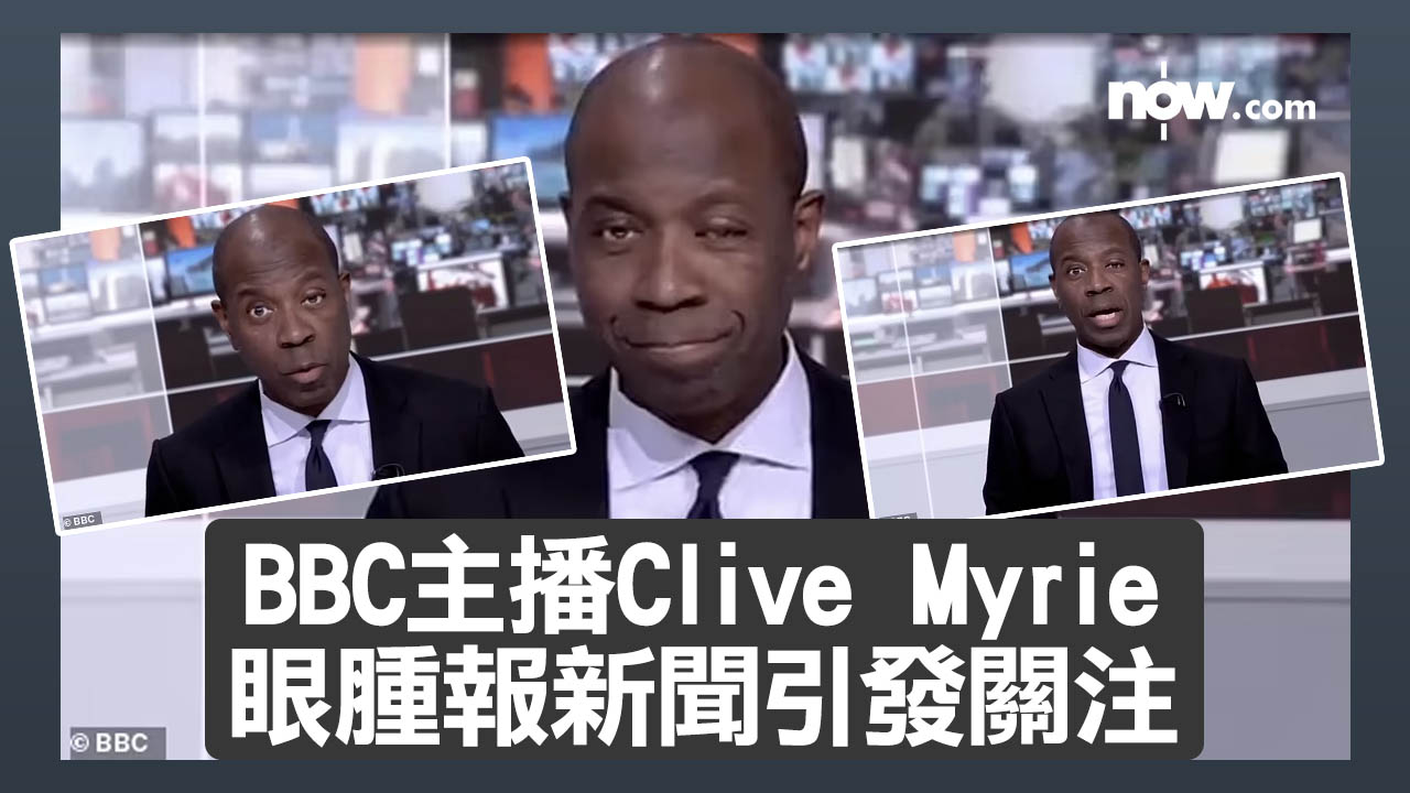 【應否出鏡？】BBC主播Clive Myrie眼腫報新聞引發關注