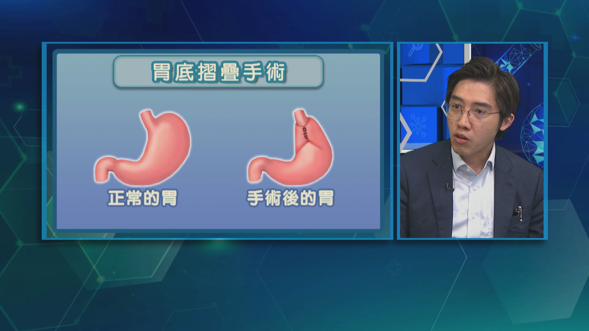 杏林在線｜胃酸倒流