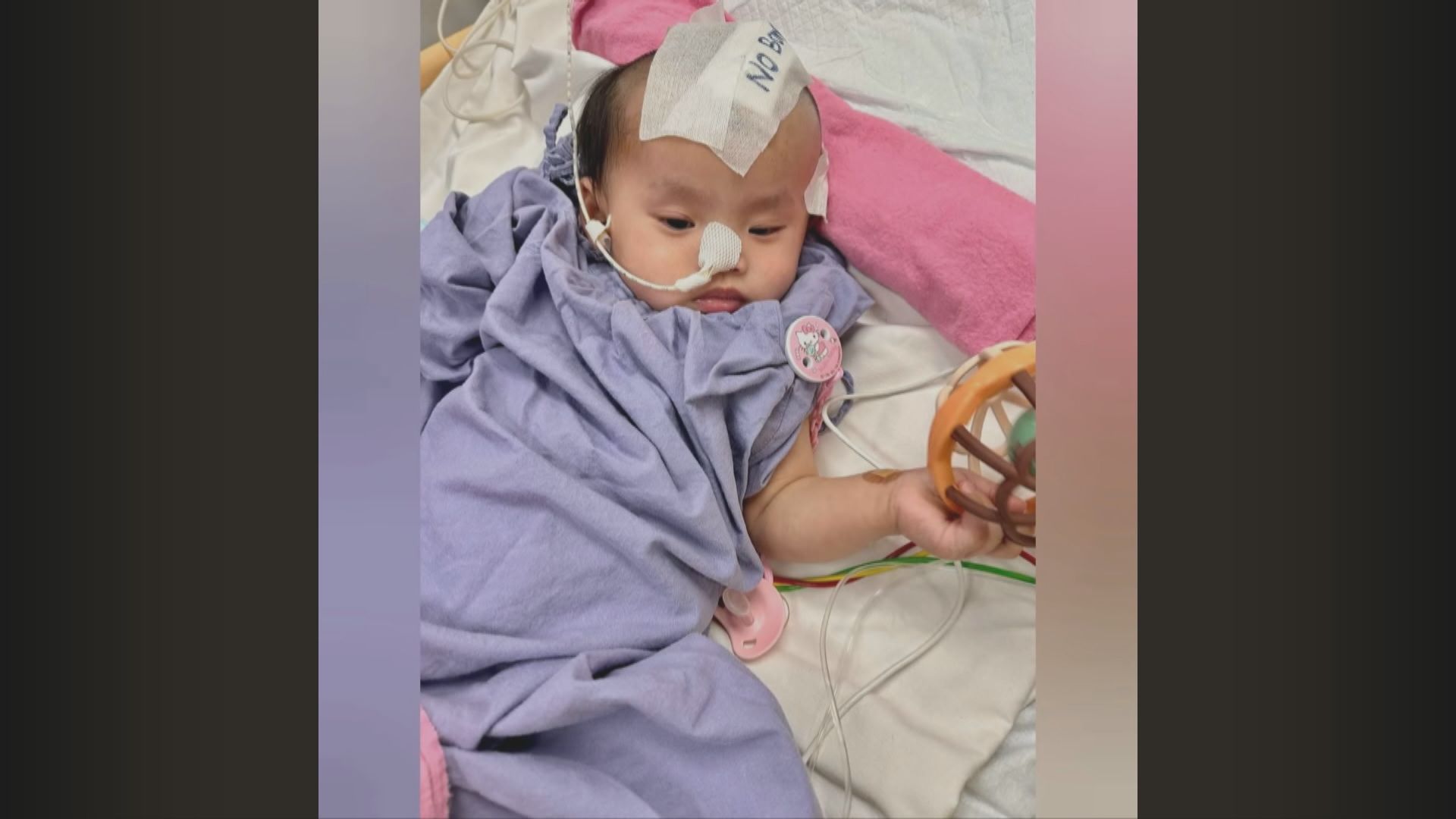屯門一歲女嬰接受頭顱骨重置手術