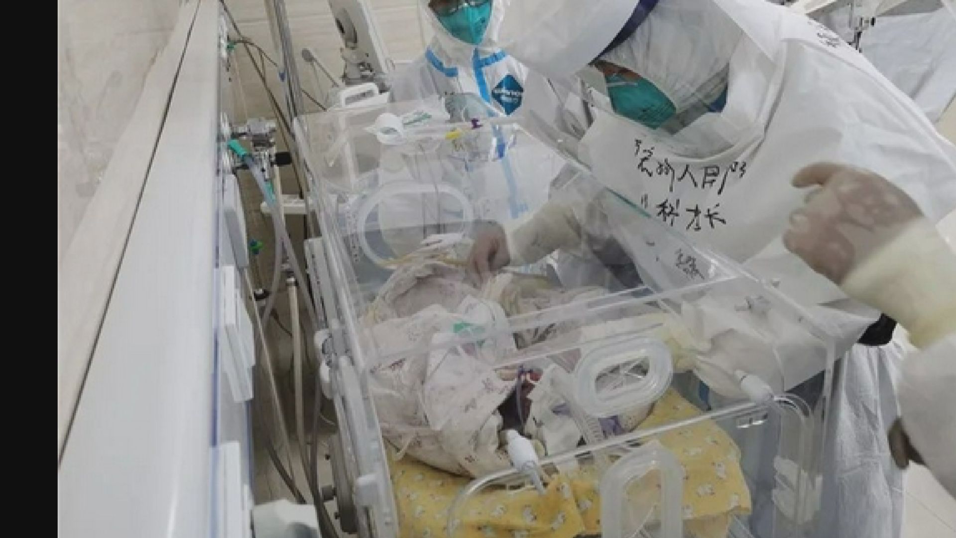 雲南新冠確診孕婦誕三胞胎　嬰兒核酸檢測呈陰性