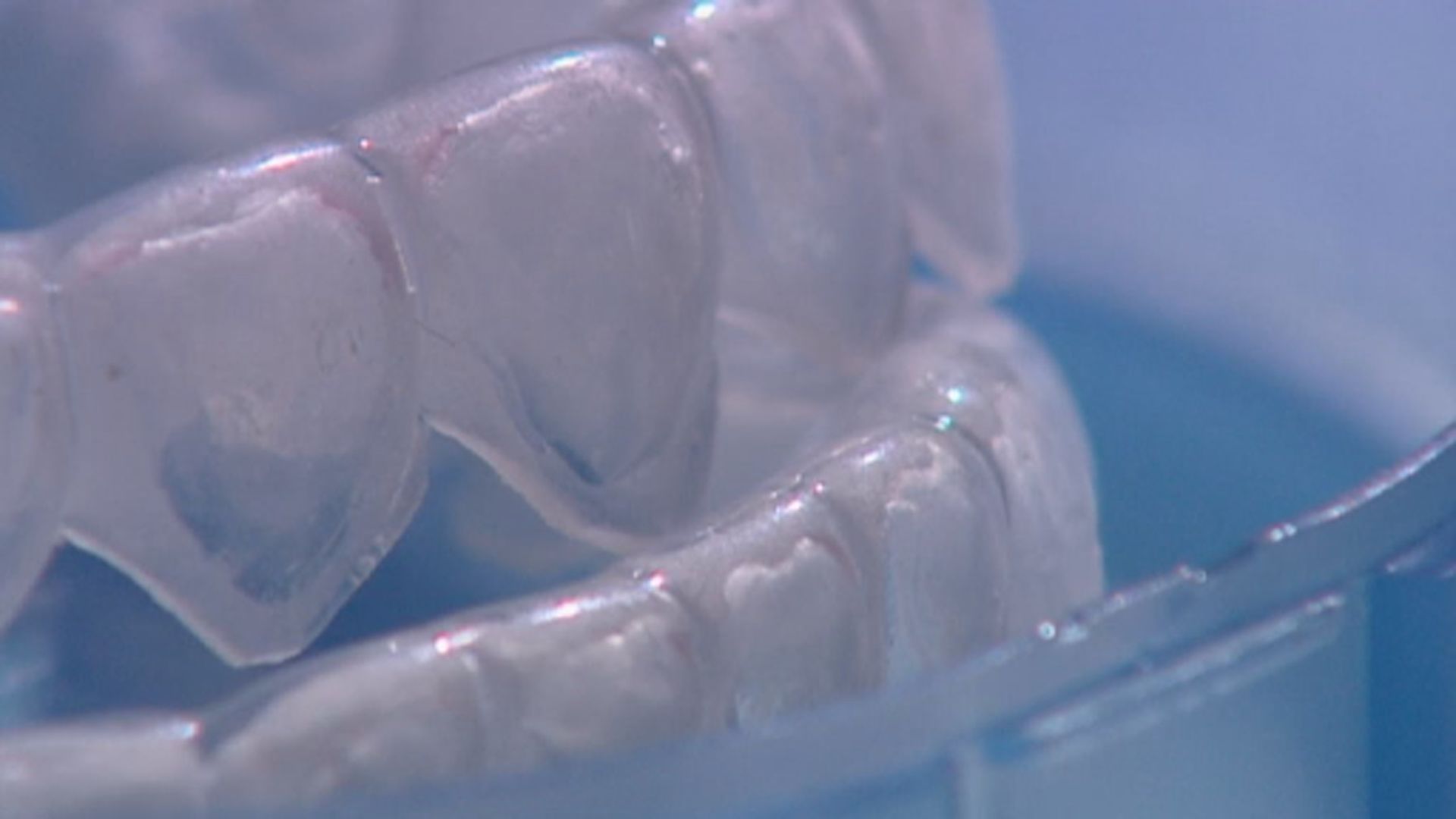 消委會：隱形牙套矯齒療程風險高　促請政府加強規管
