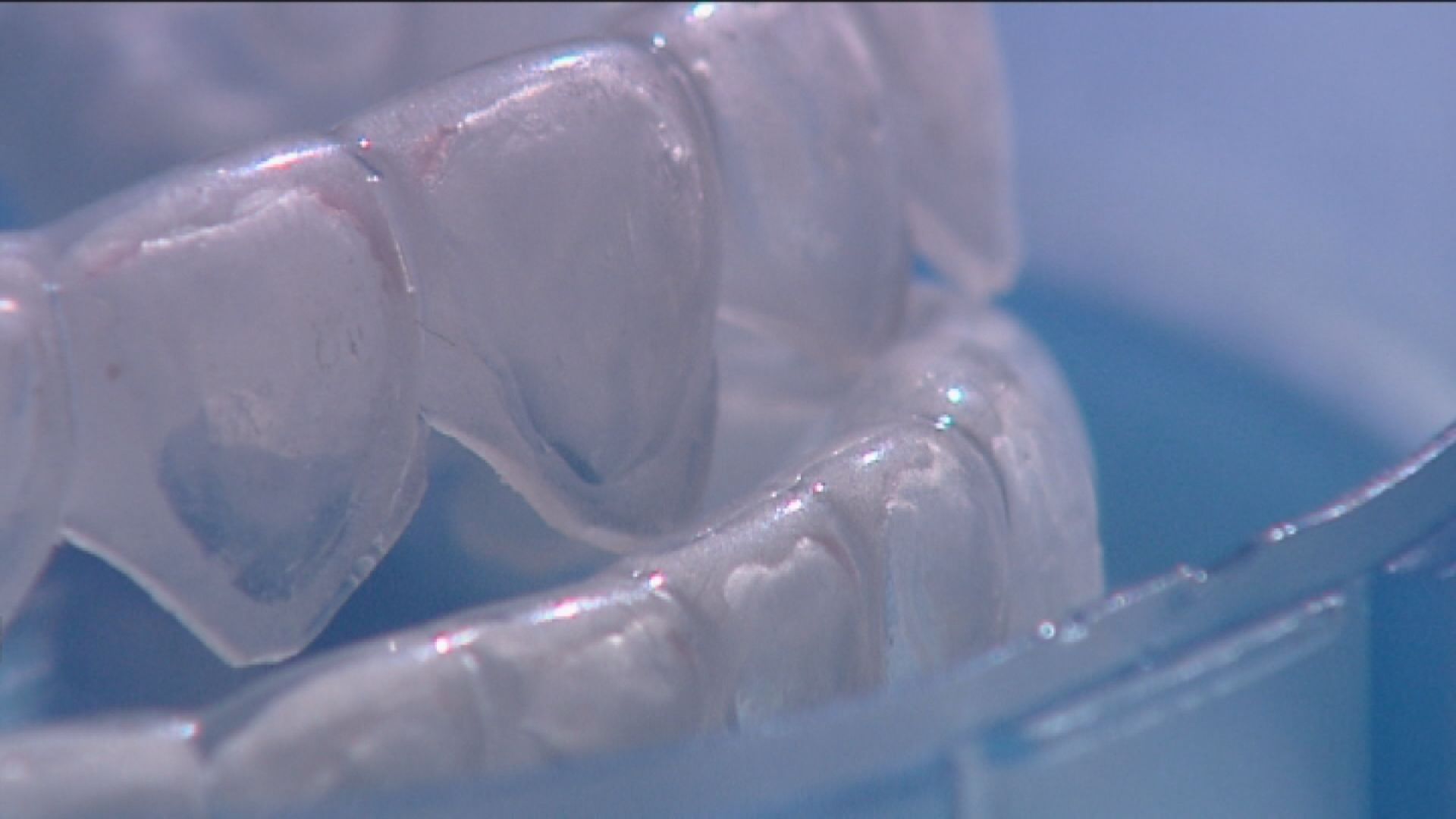 消委會：隱形牙套矯齒療程風險高　促請政府加強規管