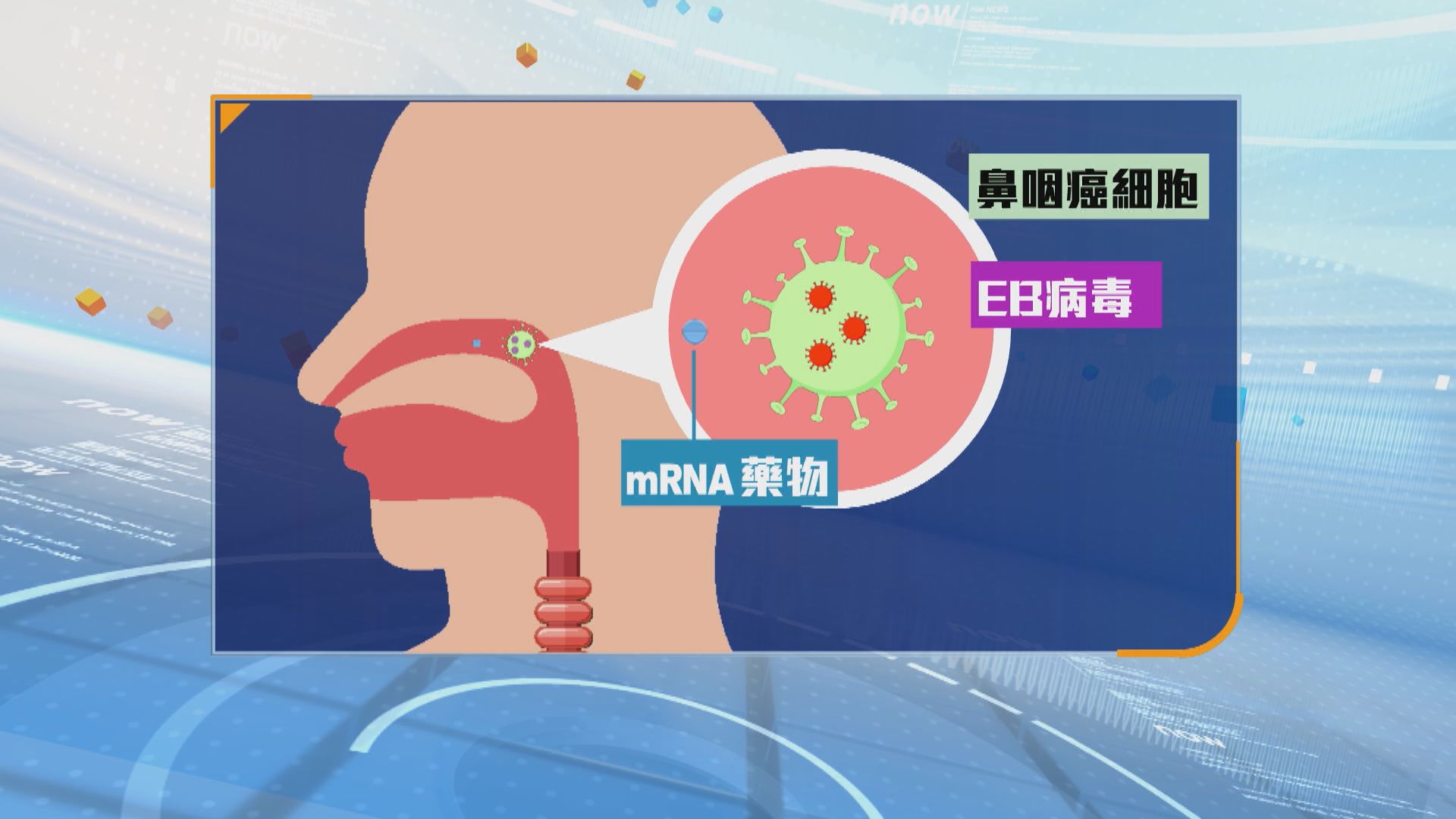 中大醫學院研mRNA藥物治鼻咽癌 「聰明導彈」專攻EB病毒