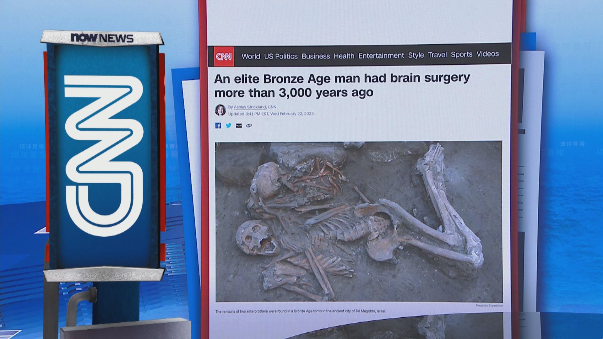An elite Bronze Age man had brain surgery more than 3,000 years ago