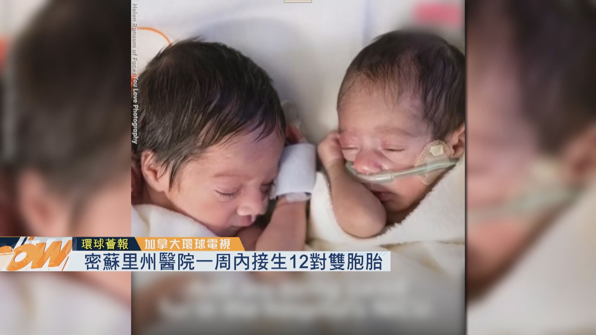 【環球薈報】美醫院一周內接生12對雙胞胎
