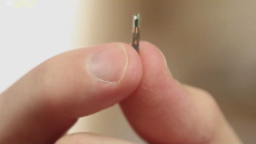 【環球薈報】美公司計劃為員工植入微晶片