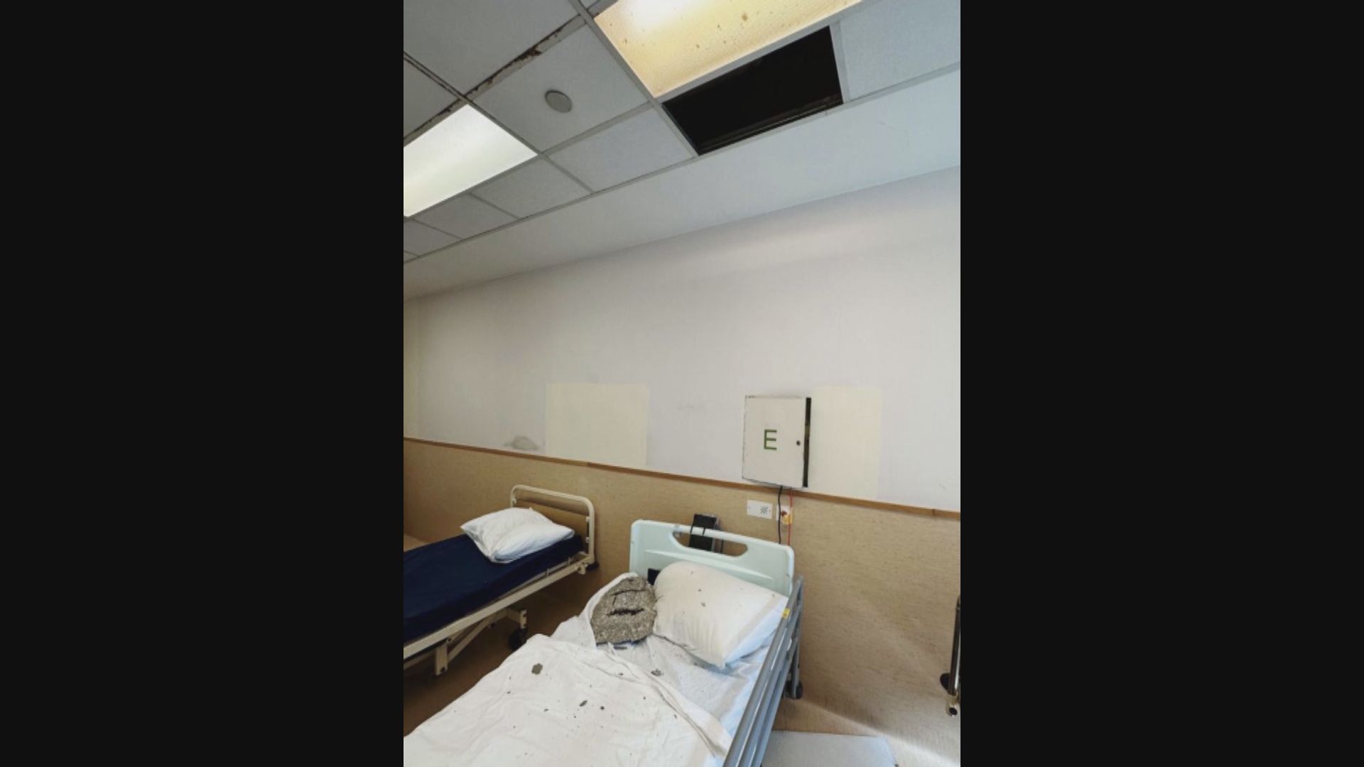 青山醫院病房去年底有「石屎」掉落　醫管局：其他醫院未發現類似風險