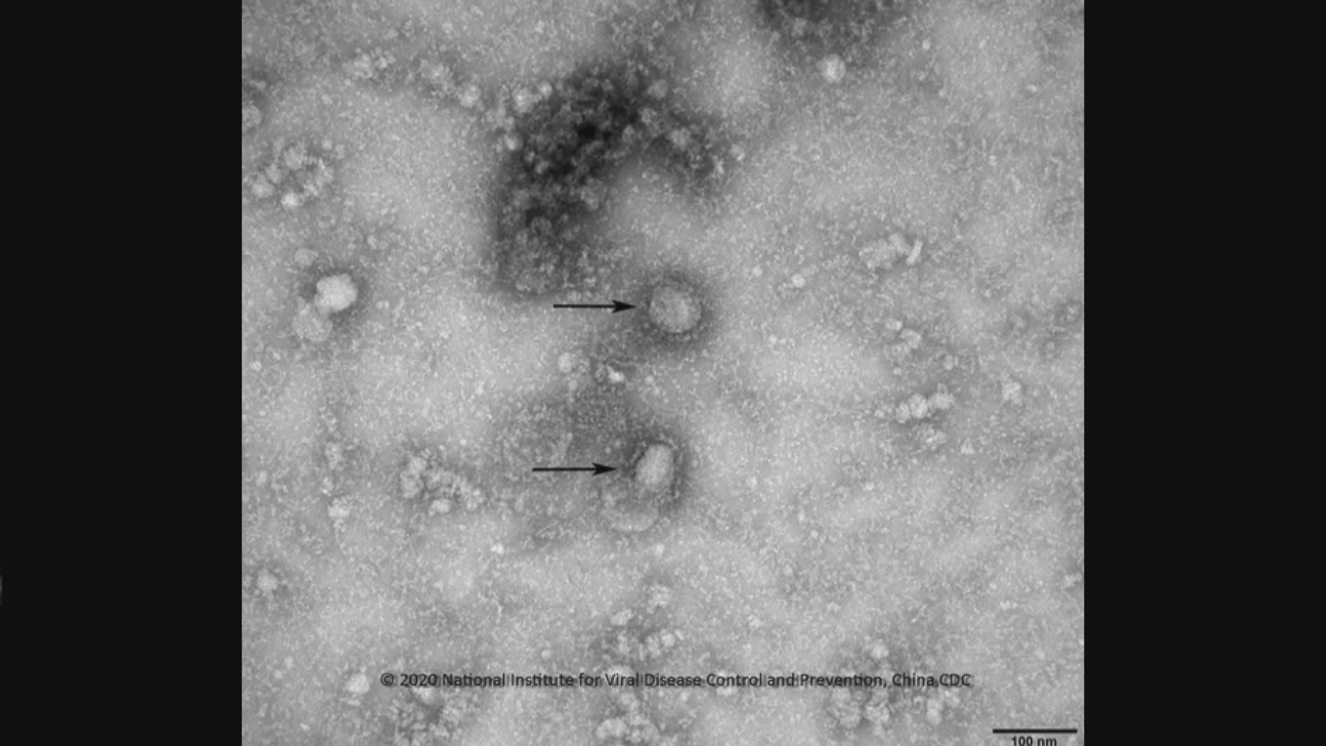 袁國勇等專家發現新型冠狀病毒較沙士更快在肺部複製