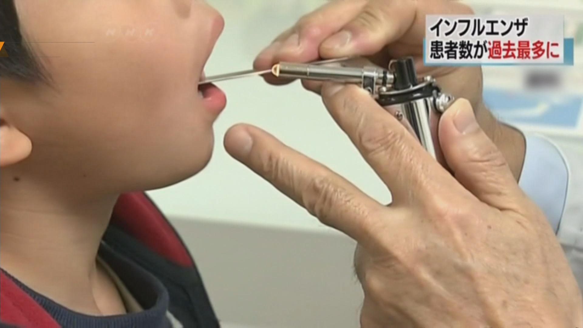 日本流感患者突破222萬　全國幼稚園停課
