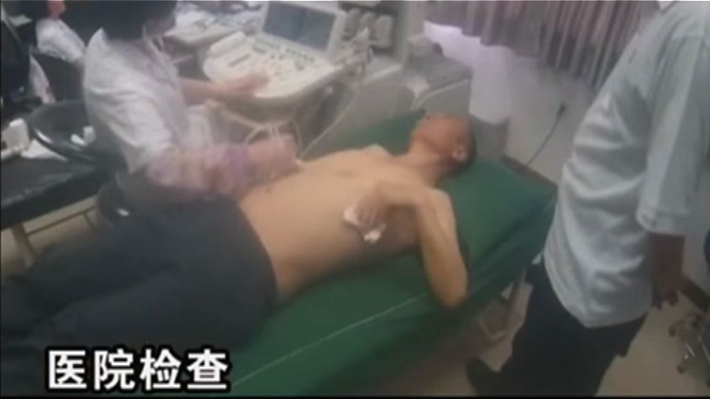 瀋陽市當局發布劉曉波發現肝癌經過