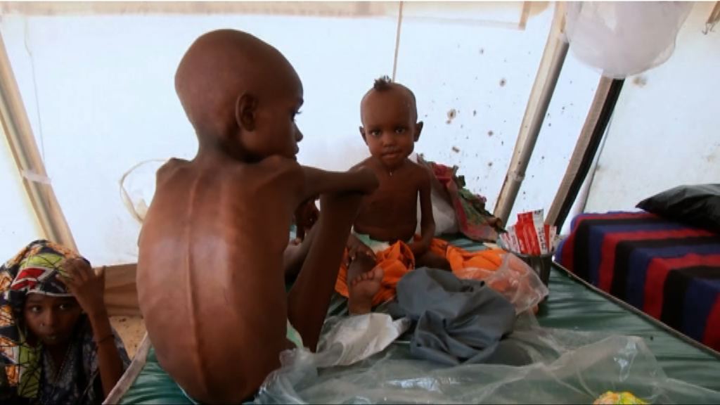 尼日利亞7.5萬名兒童瀕臨餓死