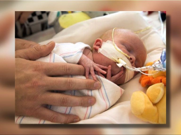
出生僅六天 嬰兒成功移植心臟