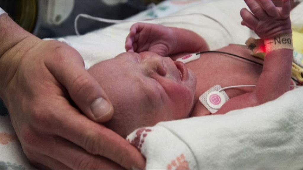 全美首宗移植子宮嬰兒誕生