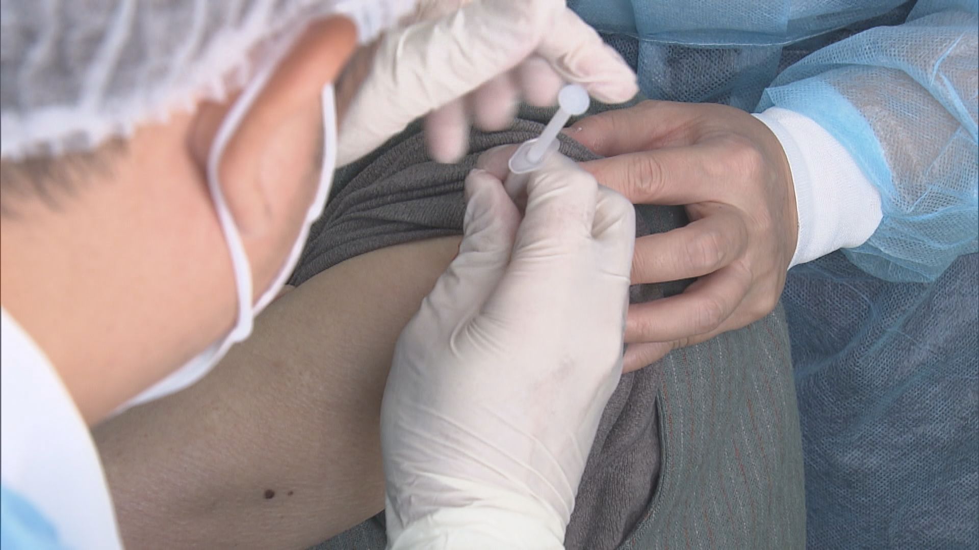 衞生署一周接44宗新冠疫苗異常事件報告　10歲男童疑有心肌炎或心包炎