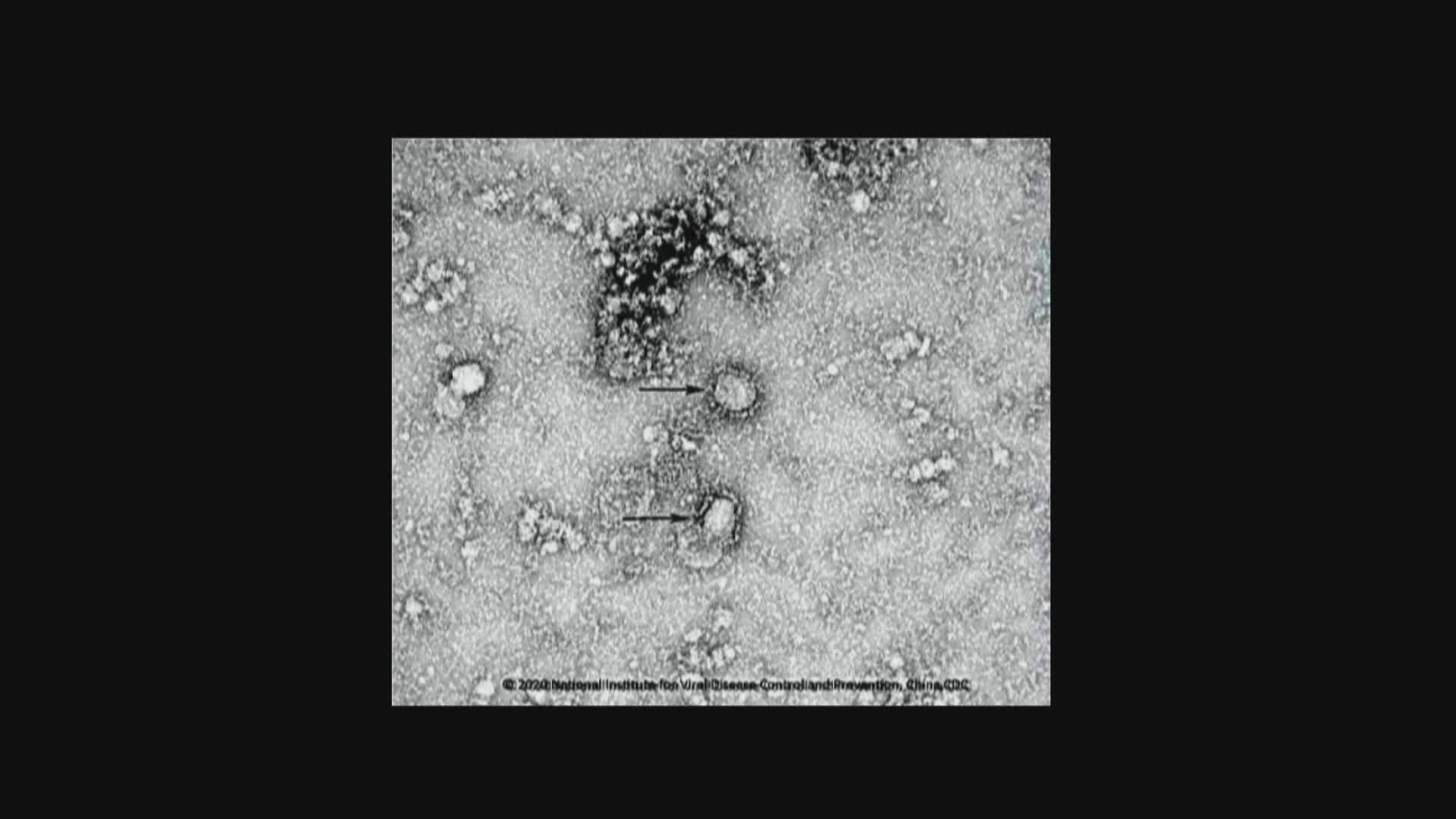 內地研究：新型冠狀病毒突變兩個亞型